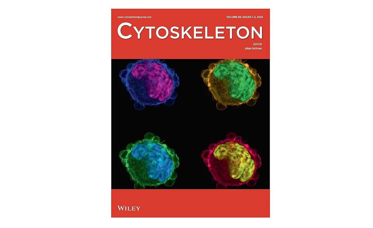 Cover story Cytoskeleton
