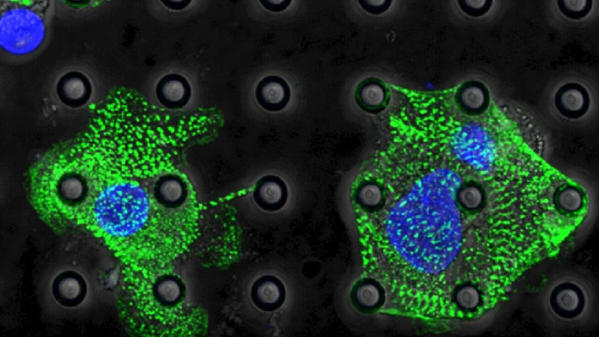 Nanostructures and cells